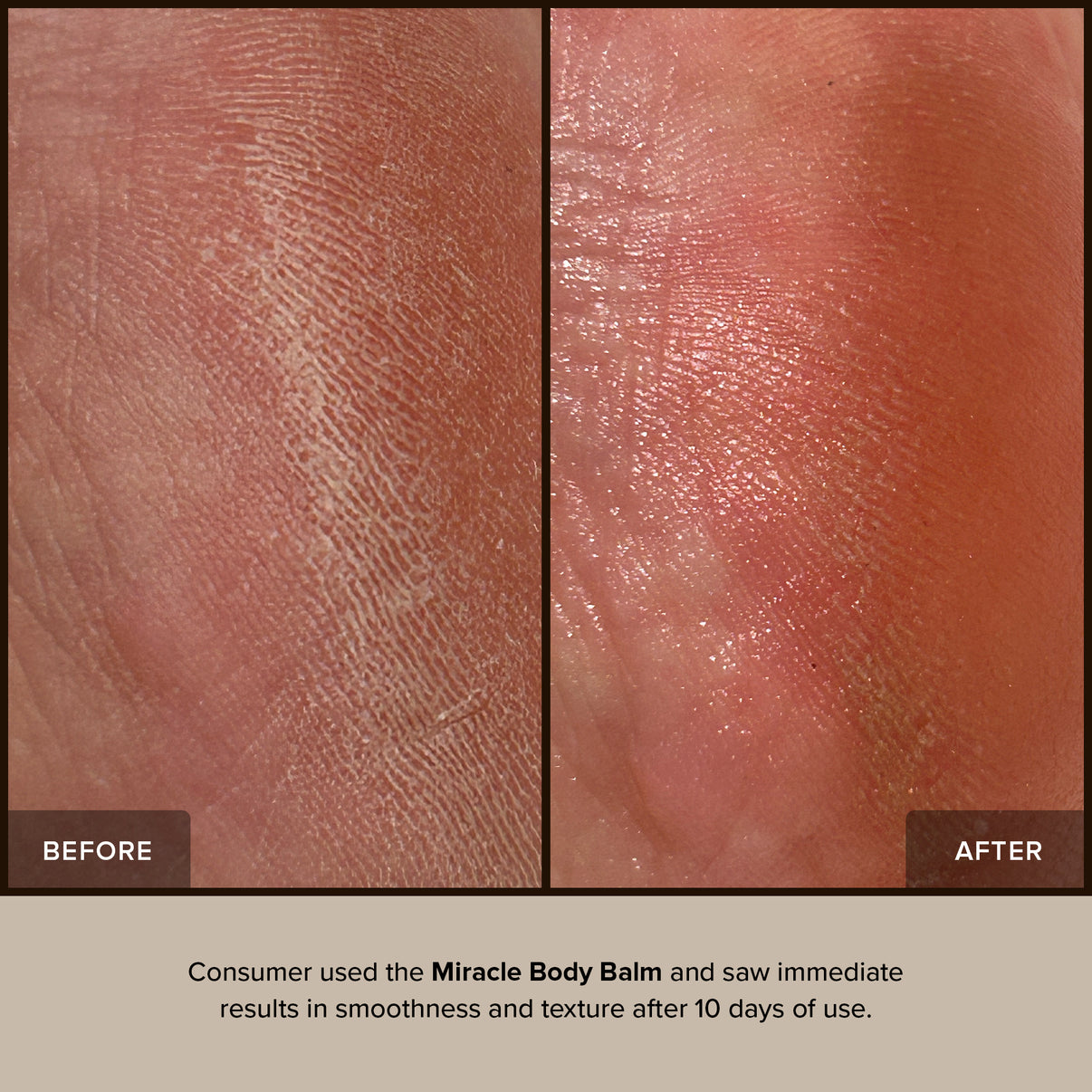 MIRACLE BODY BALM