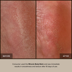 MIRACLE BODY BALM